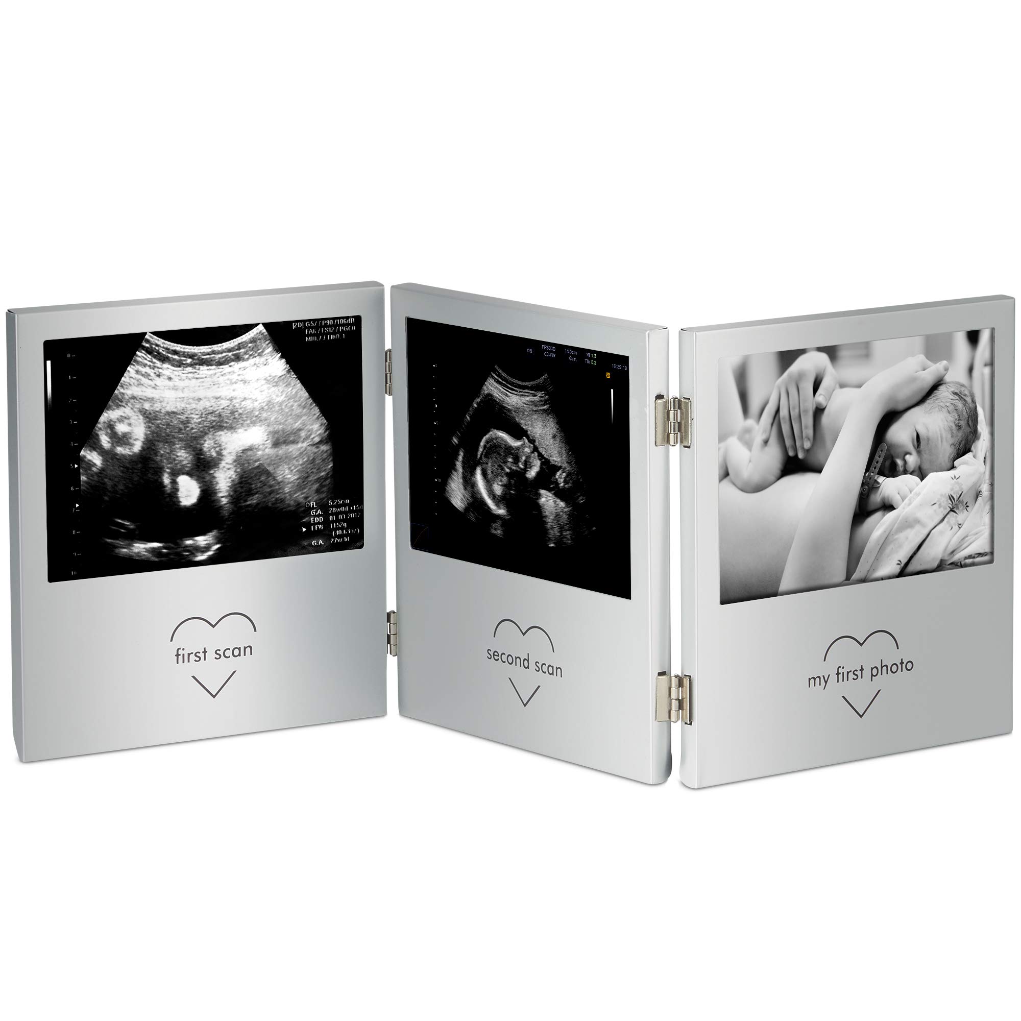 VonHaus Cornice Foto Tripla Baby Scan Ecografia